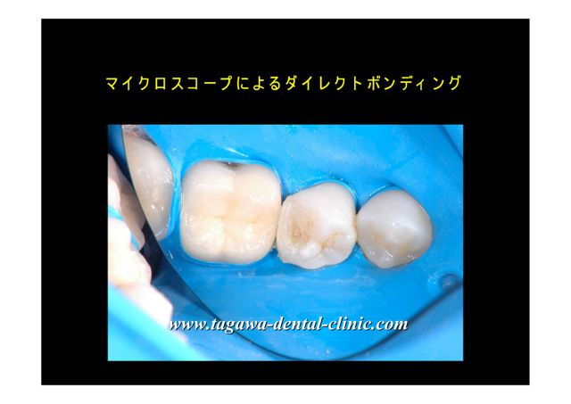 接着操作を確認しているマイクロスコープ画像